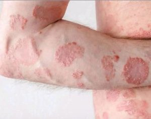These are the consequences of sleeping with the… See more